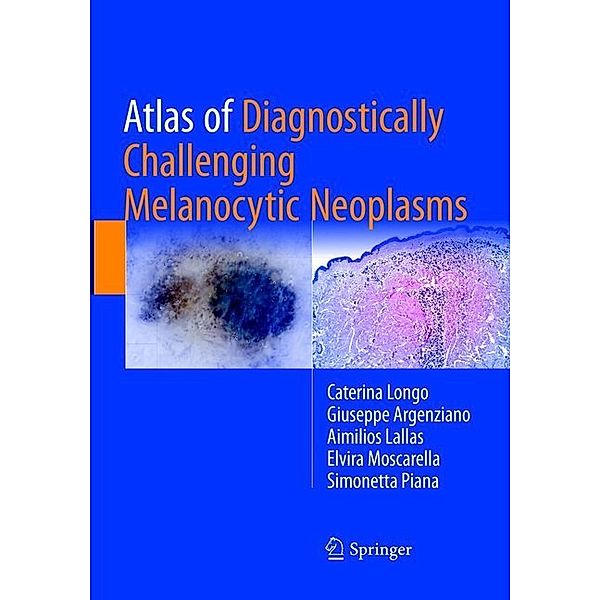 Atlas of Diagnostically Challenging Melanocytic Neoplasms, Caterina Longo, Giuseppe Argenziano, Aimilios Lallas, Elvira Moscarella, Simonetta Piana