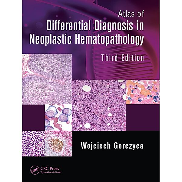 Atlas of Differential Diagnosis in Neoplastic Hematopathology, Wojciech Gorczyca