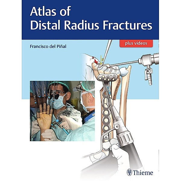 Atlas of Distal Radius Fractures, Francisco del Piñal