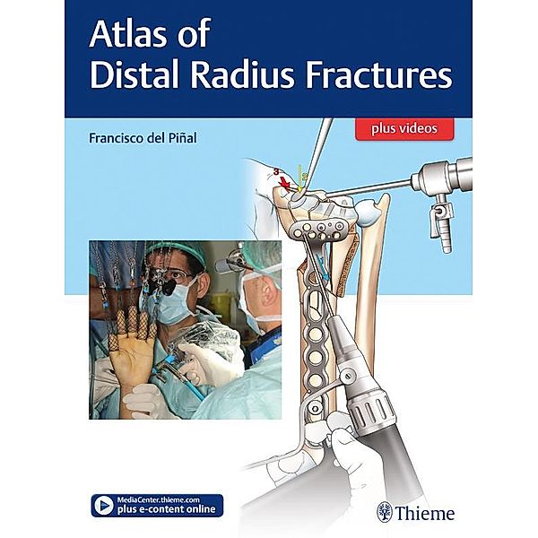 Atlas of Distal Radius Fractures, Francisco Del Pinal