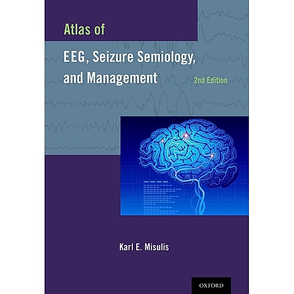 Atlas of EEG, Seizure Semiology, and Management, Karl E. Misulis