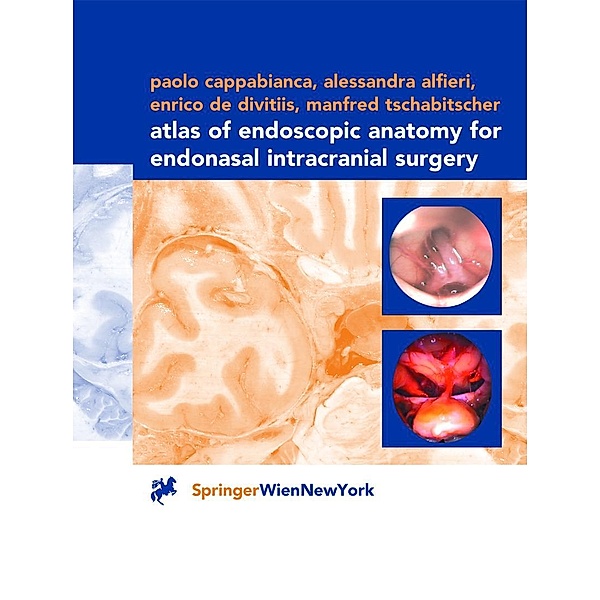 Atlas of Endoscopic Anatomy for Endonasal Intracranial Surgery, Paolo Cappabianca, Alessandra Alfieri, Enrico de Divitiis, Manfred Tschabitscher