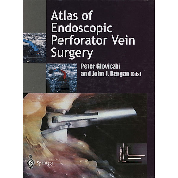 Atlas of Endoscopic Perforator Vein Surgery