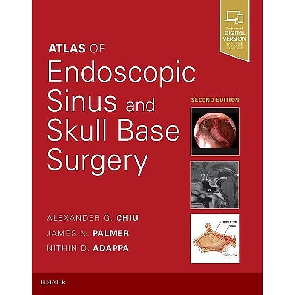 Atlas of Endoscopic Sinus and Skull Base Surgery, Nithin D Adappa, Alexander G. Chiu