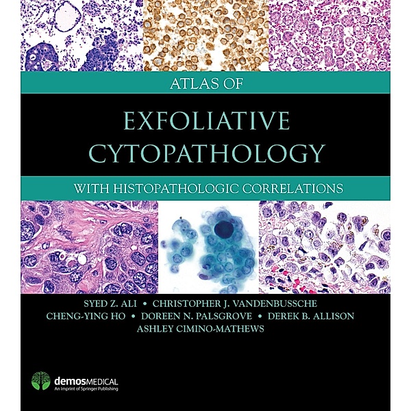 Atlas of Exfoliative Cytopathology, Syed Z. Ali, Christopher J. Vandenbussche, Cheng-Ying Ho, Doreen N. Palsgrove, Derek B. Allison, Ashley Cimino-Mathews
