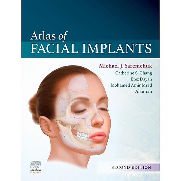 Atlas of Facial Implants, Michael J. Yaremchuk
