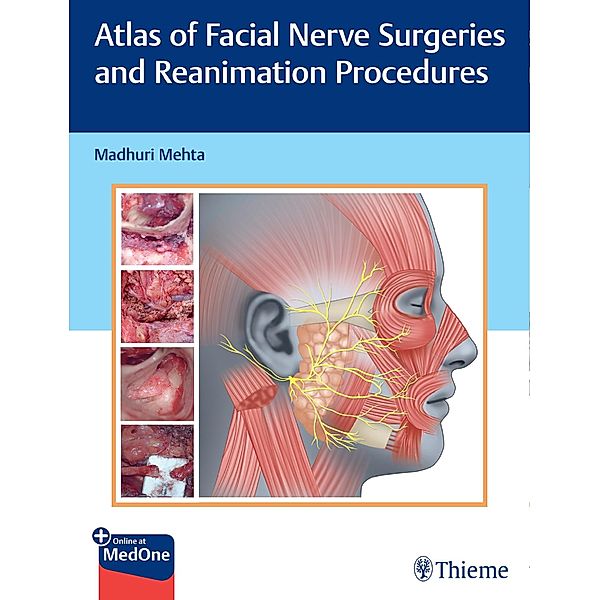 Atlas of Facial Nerve Surgeries and Reanimation Procedures, Madhuri Mehta