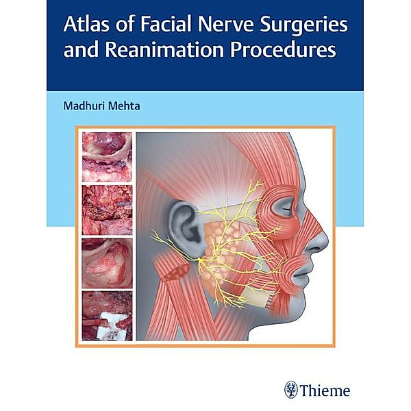 Atlas of Facial Nerve Surgeries and Reanimation Procedures