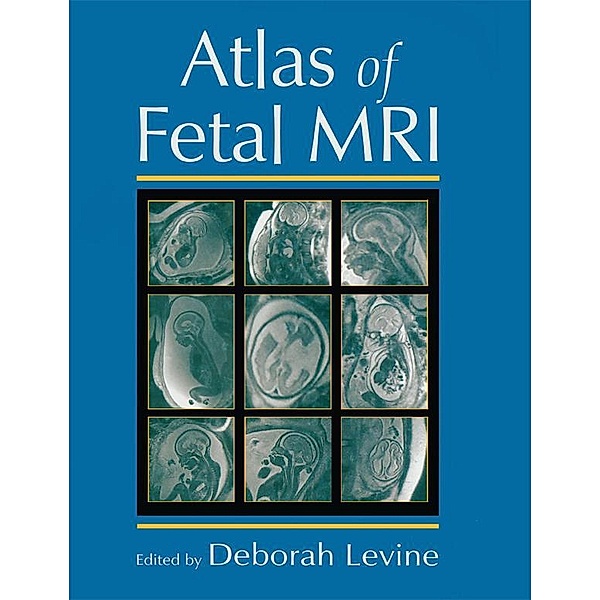 Atlas of Fetal MRI, Deborah Levine