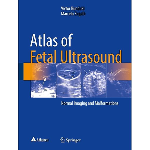 Atlas of Fetal Ultrasound, Victor Bunduki, Marcelo Zugaib