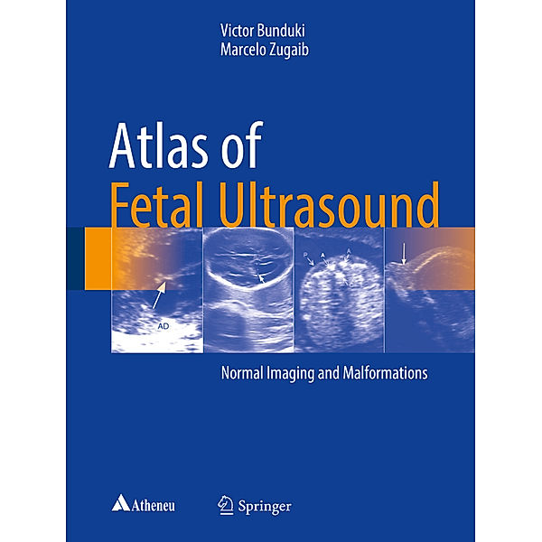 Atlas of Fetal Ultrasound, Victor Bunduki, Marcelo Zugaib