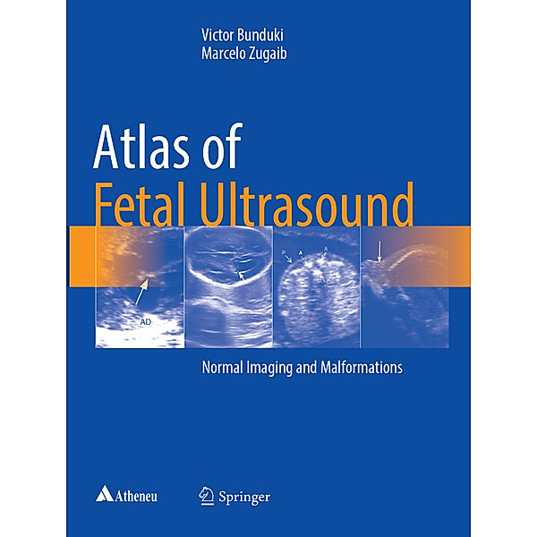 Atlas of Fetal Ultrasound, Victor Bunduki, Marcelo Zugaib