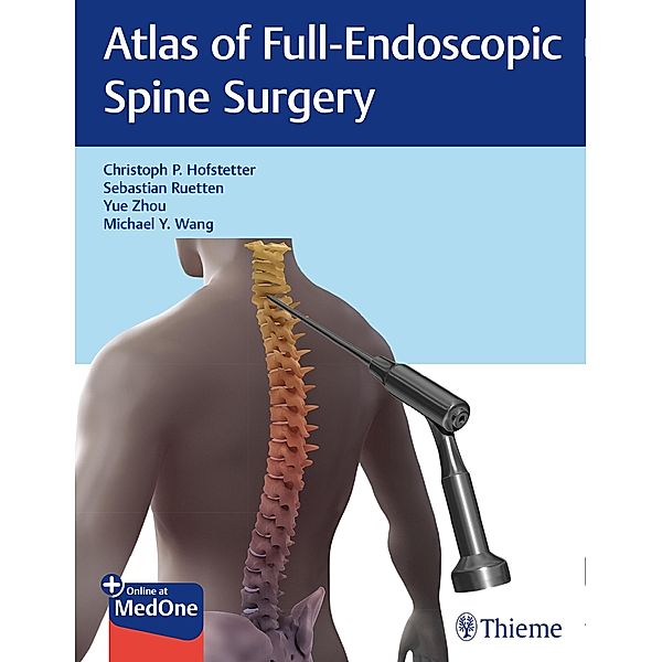 Atlas of Full-Endoscopic Spine Surgery, Christoph Hofstetter, Sebastian Ruetten, Yue Zhou, Michael Wang