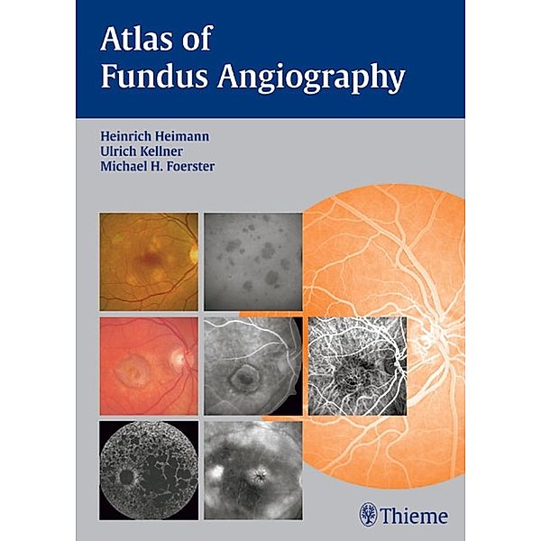 Atlas of Fundus Angiography