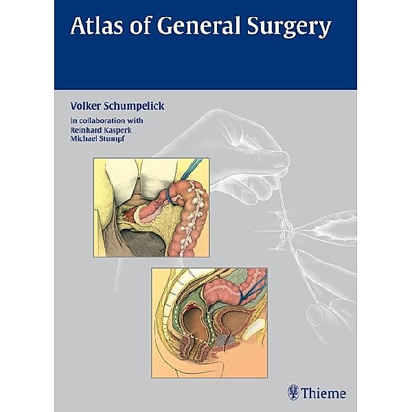 Atlas of General  Surgery, Volker Schumpelick