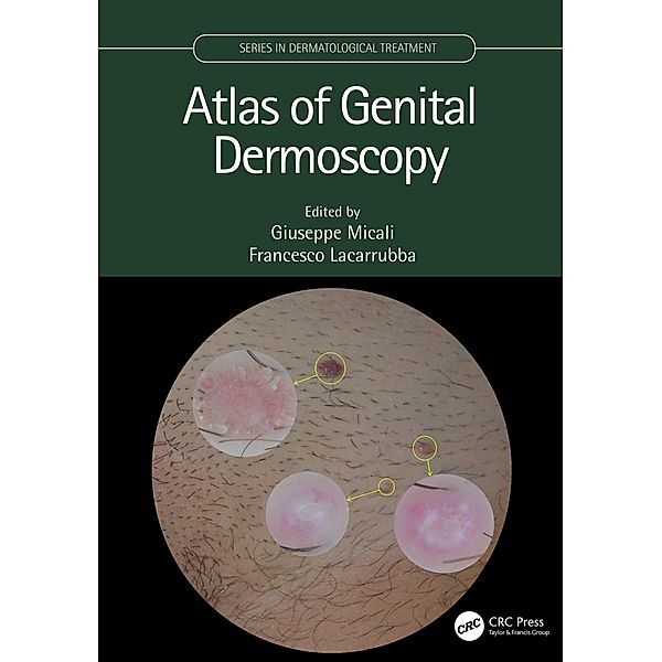 Atlas of Genital Dermoscopy