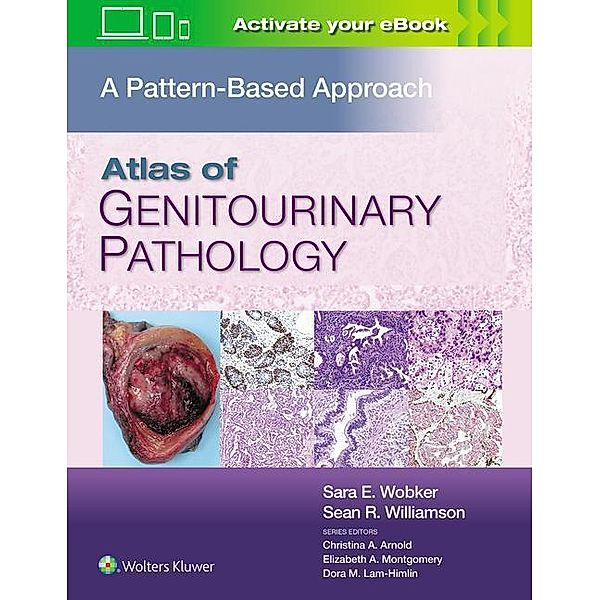Atlas of Genitourinary Pathology, Sara E., MD, MPH Wobker, Sean R., MD, FASCP Williamson