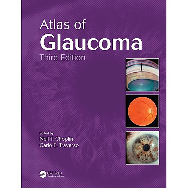 Atlas of Glaucoma