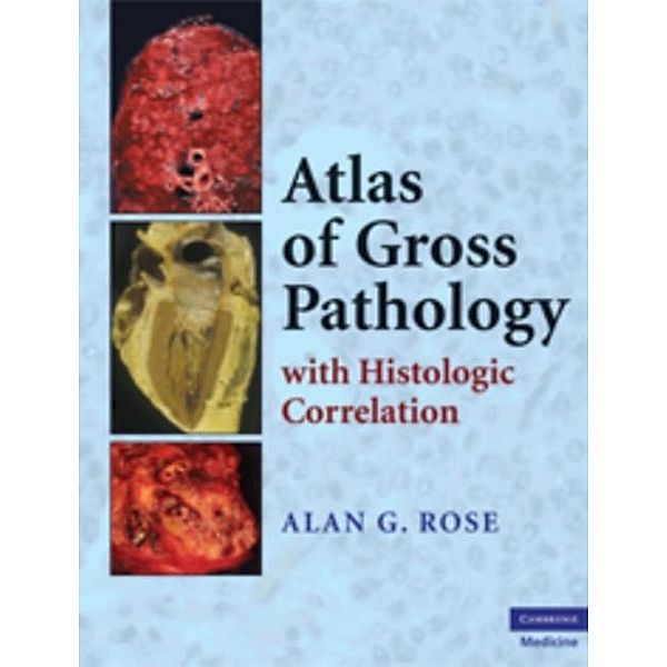 Atlas of Gross Pathology, Alan G. Rose