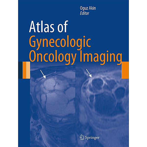 Atlas of Gynecologic Oncology Imaging