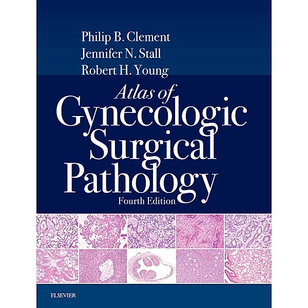 Atlas of Gynecologic Surgical Pathology E-Book, Philip B. Clement, Robert H. Young, Jennifer Stall