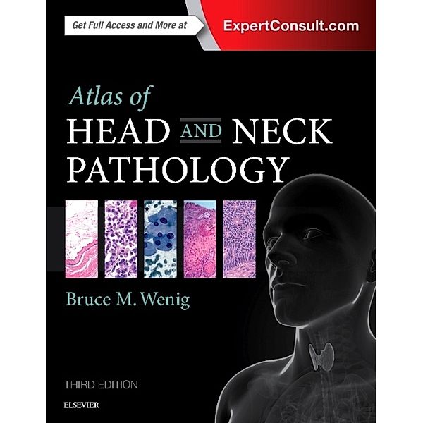 Atlas of Head and Neck Pathology, Bruce M. Wenig