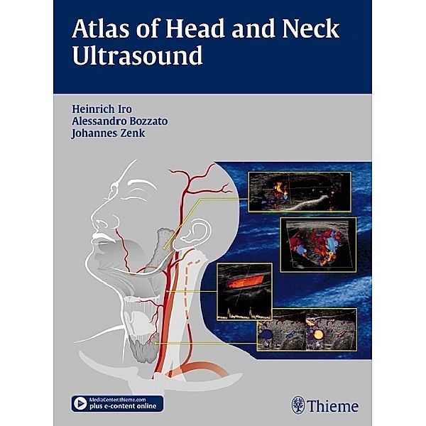 Atlas of Head and Neck Ultrasound, Heinrich Iro, Alessandro Bozzato, Johannes Zenk