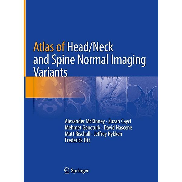 Atlas of Head/Neck and Spine Normal Imaging Variants, Alexander McKinney, Zuzan Cayci, Mehmet Gencturk, David Nascene, Matt Rischall, Jeffrey Rykken, Frederick Ott