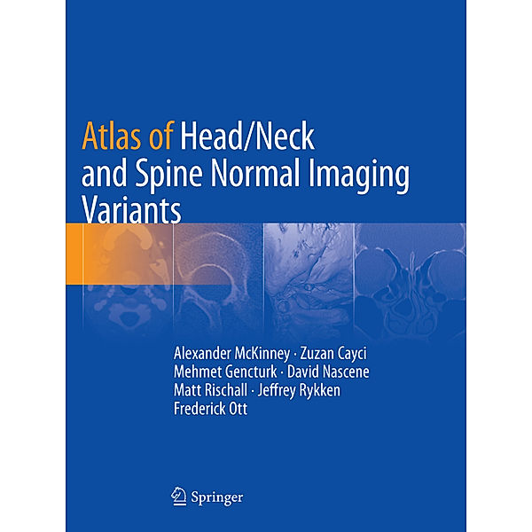 Atlas of Head/Neck and Spine Normal Imaging Variants, Alexander McKinney, Zuzan Cayci, Mehmet Gencturk, David Nascene, Matt Rischall, Jeffrey Rykken, Frederick Ott