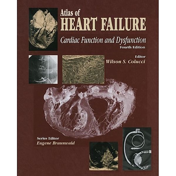Atlas of HEART FAILURE