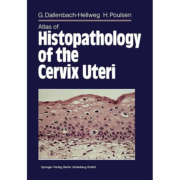 Atlas of Histopathology of the Cervix Uteri, Gisela Dallenbach-Hellweg, Magnus von Knebel Doeberitz, Marcus J. Trunk-Gemacher