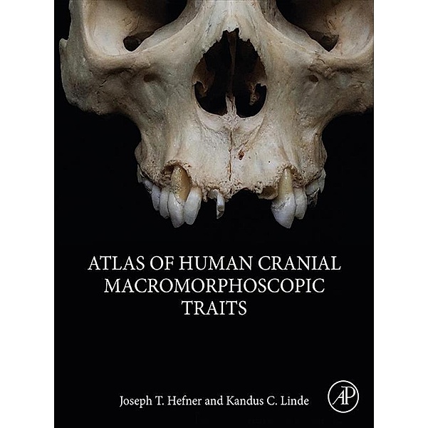 Atlas of Human Cranial Macromorphoscopic Traits, Joseph T. Hefner, Kandus C. Linde