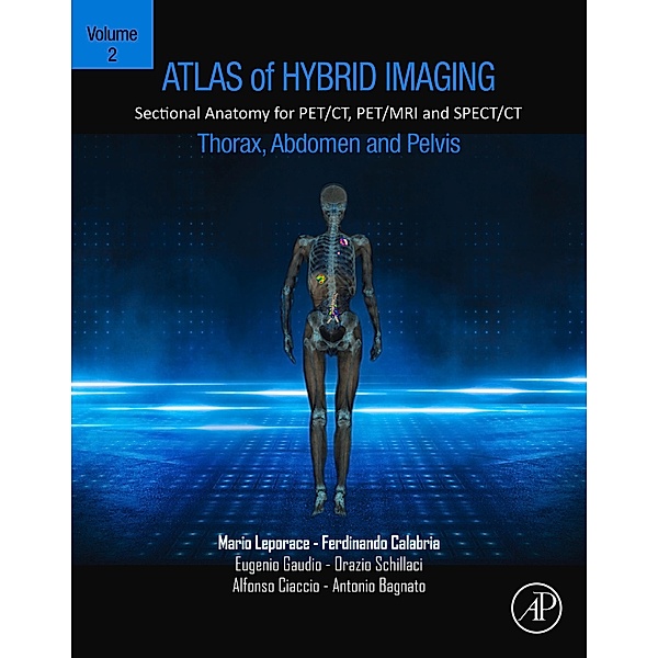 Atlas of Hybrid Imaging Sectional Anatomy for PET/CT, PET/MRI and SPECT/CT Vol. 2: Thorax Abdomen and Pelvis, Mario Leporace, Ferdinando Calabria, Eugenio Gaudio, Orazio Schillaci, Alfonso Ciaccio, Antonio Bagnato