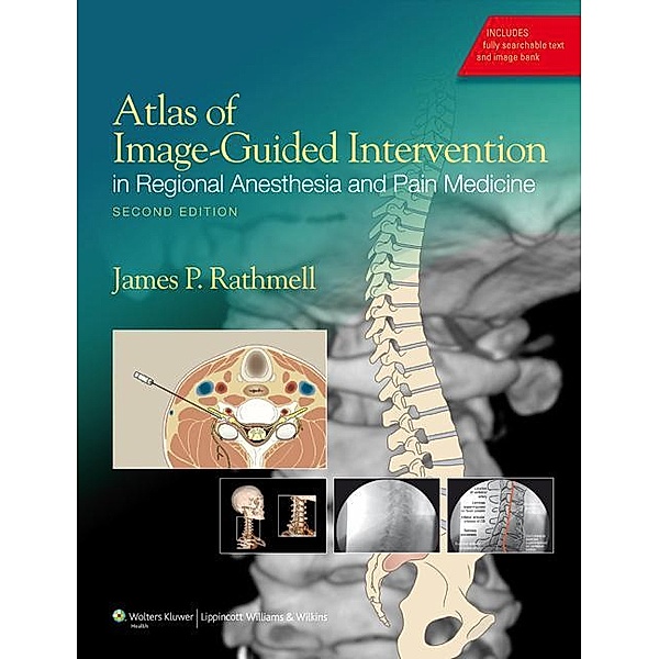 Atlas of Image-Guided Intervention in Regional Anesthesia and Pain Medicine, S. Jean Emans