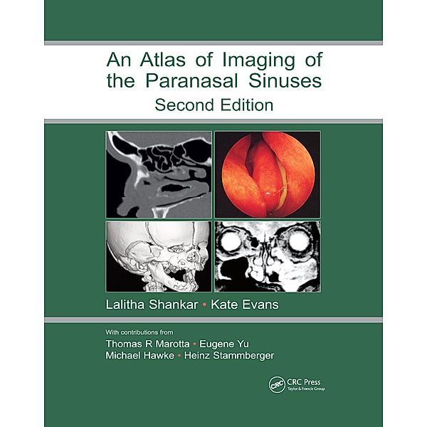 Atlas of Imaging of the Paranasal Sinuses, Second Edition