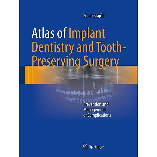 Atlas of Implant Dentistry and Tooth-Preserving Surgery, Zoran Stajcic