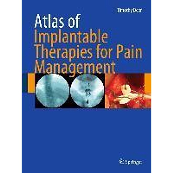 Atlas of Implantable Therapies for Pain Management, Timothy R Deer
