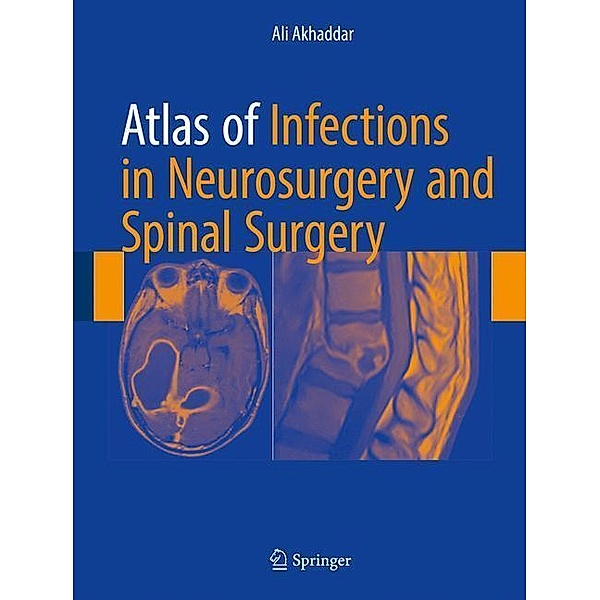 Atlas of Infections in Neurosurgery and Spinal Surgery, Ali Akhaddar
