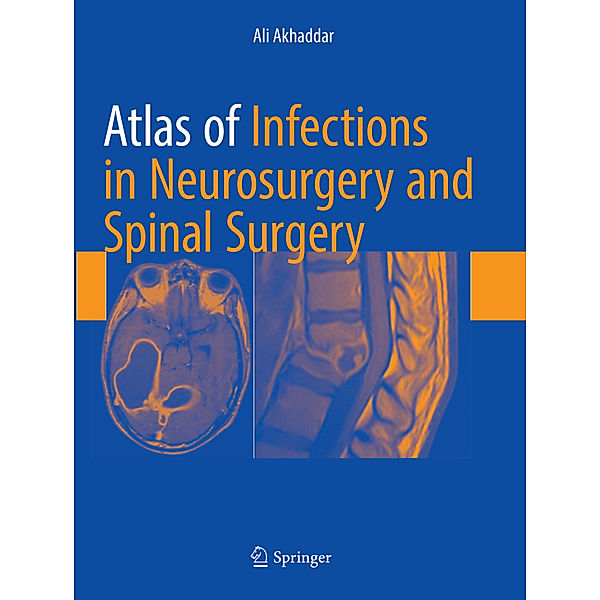 Atlas of Infections in Neurosurgery and Spinal Surgery, Ali Akhaddar