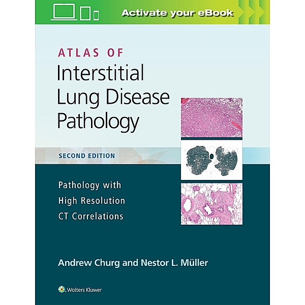 Atlas of Interstitial Lung Disease Pathology, Andrew Churg, Nestor L. Müller