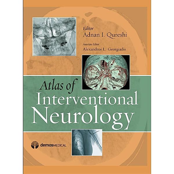 Atlas of Interventional Neurology, Alexandros Georgiadis, Adnan I. Qureshi