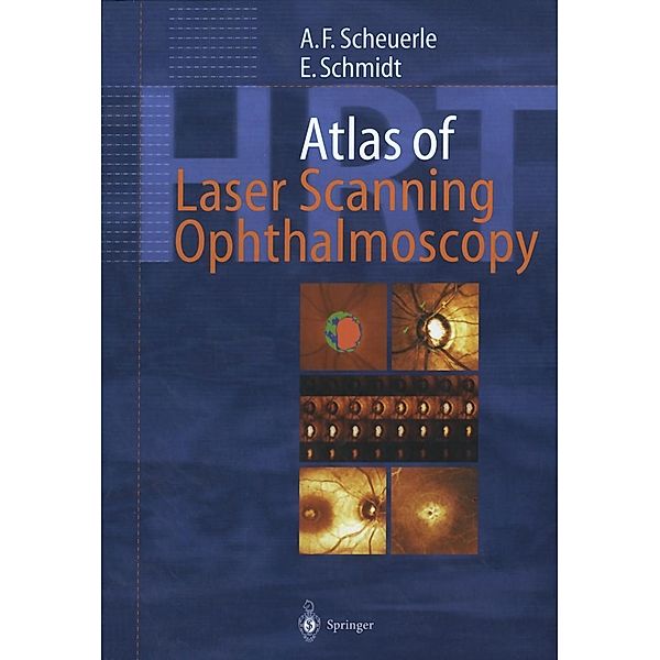 Atlas of Laser Scanning Ophthalmoscopy, Alexander Friedrich Scheuerle, Eckart Schmidt