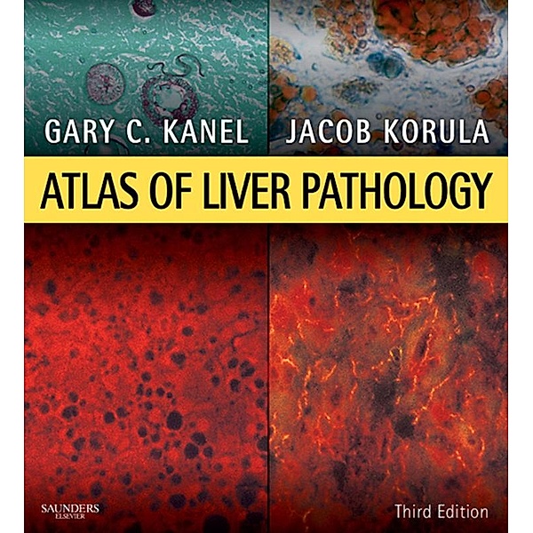 Atlas of Liver Pathology E-Book, Gary C. Kanel, Jacob Korula