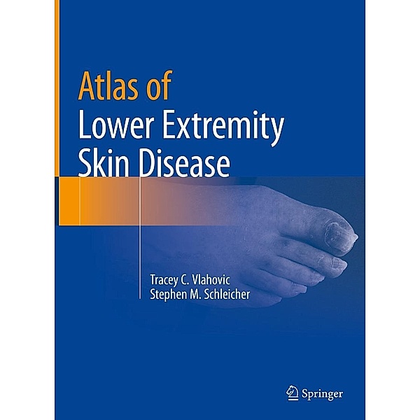 Atlas of Lower Extremity Skin Disease, Tracey C. Vlahovic, Stephen M. Schleicher