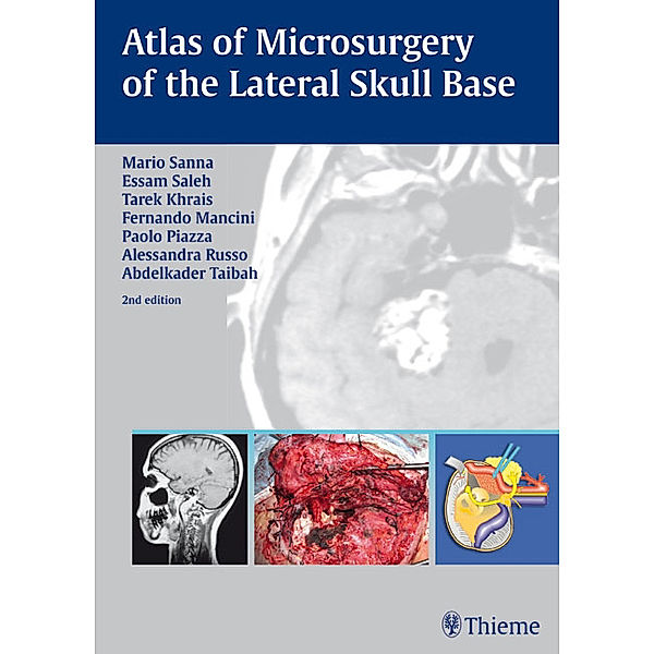 Atlas of Microsurgery of the Lateral Skull Base, Tarek Khrais, Fernando Mancini, Essam A. Saleh, Paolo Piazza, Alessandra Russo, Abdelkader Taibah