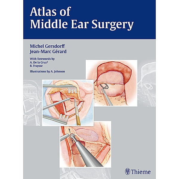 Atlas of Middle Ear Surgery, Michel Gersdorff, Jean-Marc Gérard