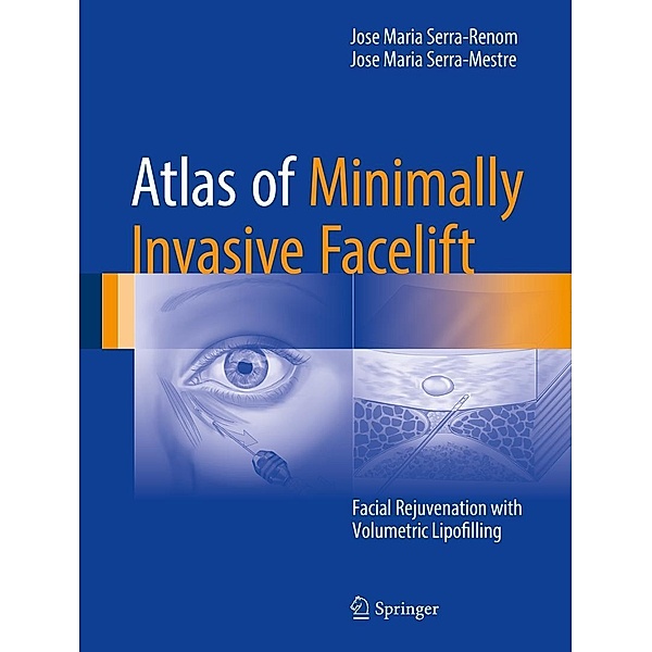 Atlas of Minimally Invasive Facelift, Jose Maria Serra-Renom, Jose Maria Serra-Mestre