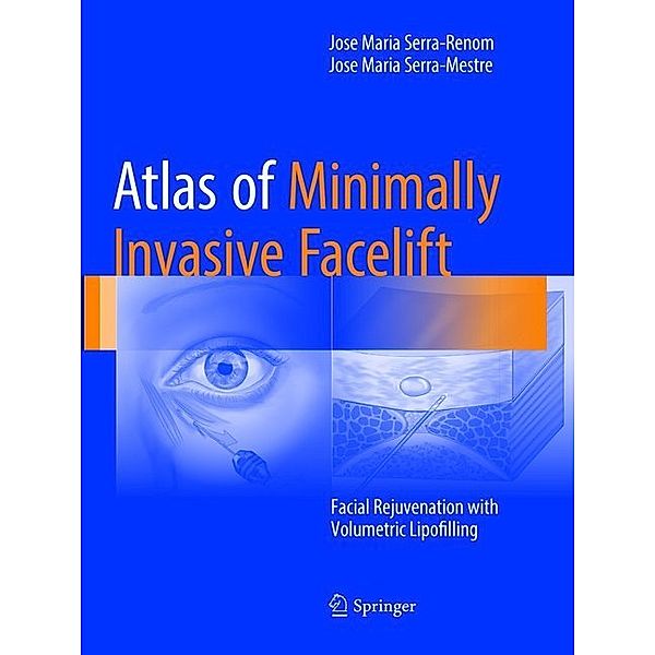 Atlas of Minimally Invasive Facelift, Jose Maria Serra-Renom, Jose Maria Serra-Mestre