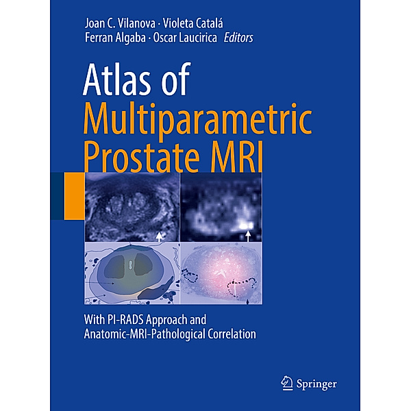 Atlas of Multiparametric Prostate MRI