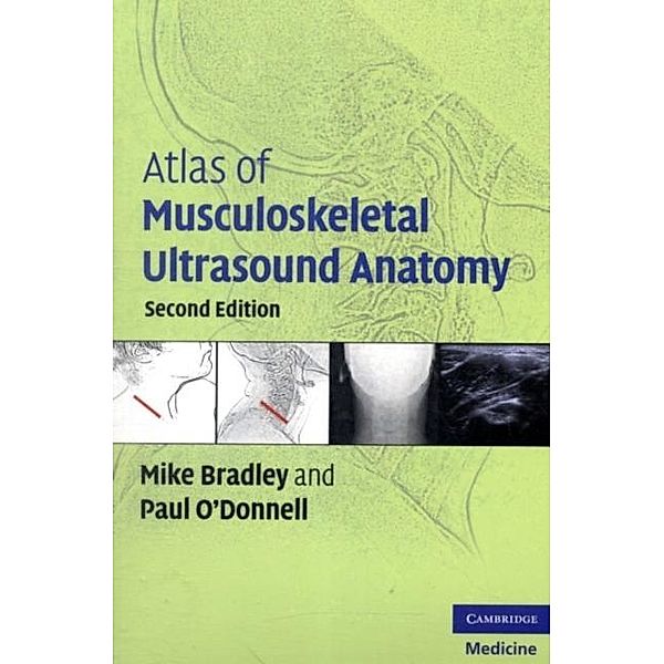 Atlas of Musculoskeletal Ultrasound Anatomy, Mike Bradley